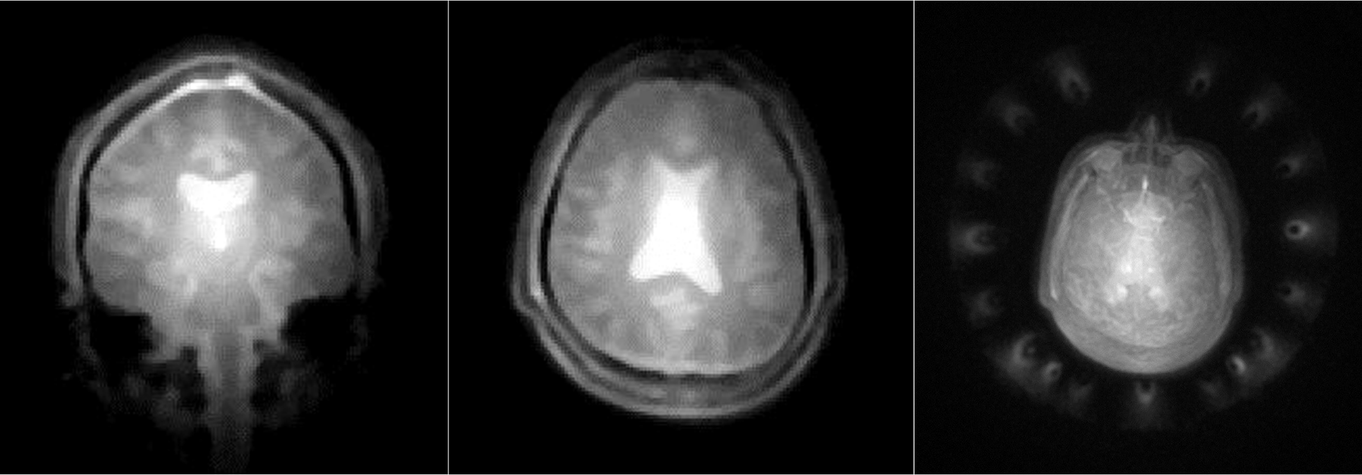 Multiple images from a MRI machine using new technology.