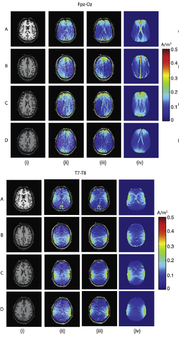 Iterations of brain scans against a black background.